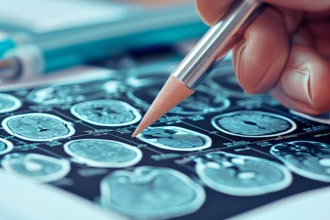 Neuropsychological testing and psychological assessment